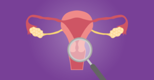 Leia mais sobre o artigo Uma em cada quatro mulheres tem útero retrovertido. Isso é perigoso?