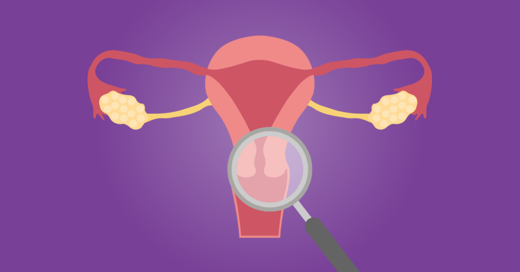 Leia mais sobre o artigo Uma em cada quatro mulheres tem útero retrovertido. Isso é perigoso?