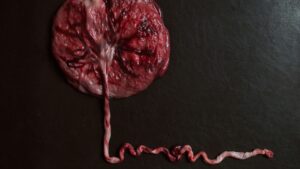 Leia mais sobre o artigo Cordão umbilical e o desenvolvimento do bebê.