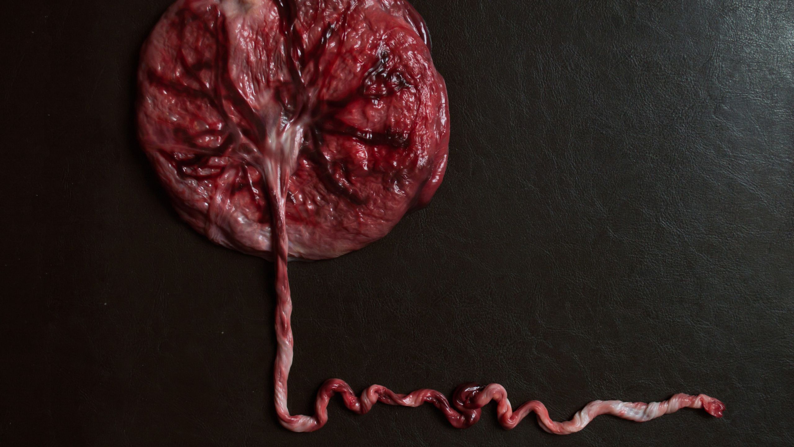 Leia mais sobre o artigo Cordão umbilical e o desenvolvimento do bebê.