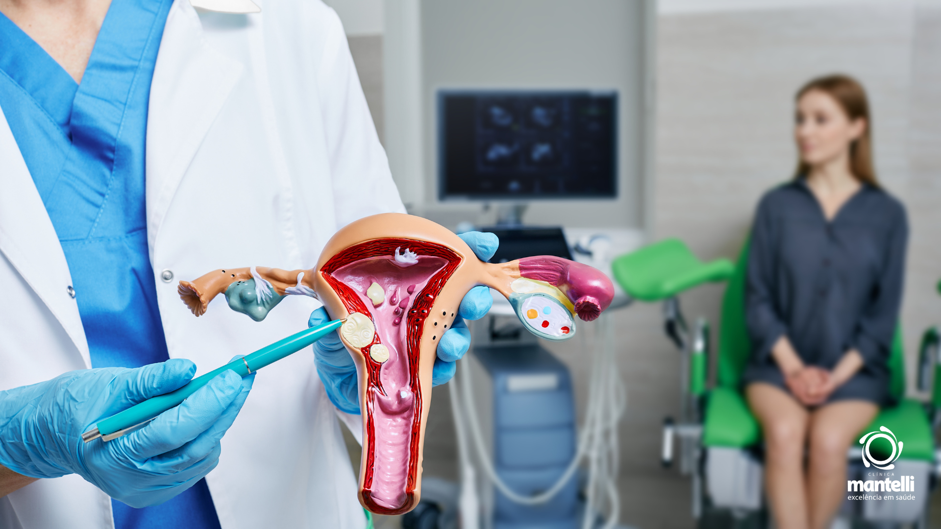 Leia mais sobre o artigo Miomas Uterinos: O que são, causas e tratamentos